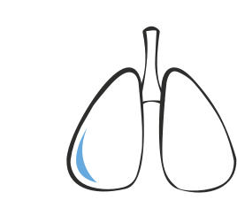 Icône illustrant des poumons avec fibrose.