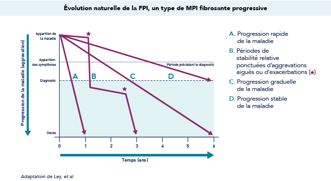 Progression de la FPI au fil du temps. Pour obtenir une description plus détaillée de ce graphique, cliquez sur le lien ci-dessous.
